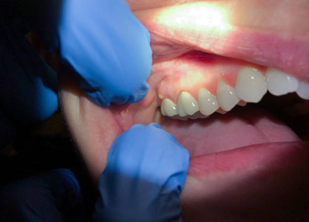 Best Weekend Emergency Dentist in Mclendon Chisholm, TX