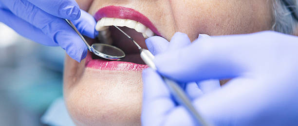 Best Emergency Tooth Extraction in Mclendon Chisholm, TX